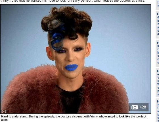 顔面にセメント注入で整形失敗、コブコブの怪物に… 衝撃的なアメリカの整形手術3例の画像4