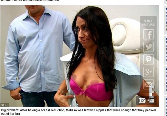 顔面にセメント注入で整形失敗、コブコブの怪物に… 衝撃的なアメリカの整形手術3例の画像5