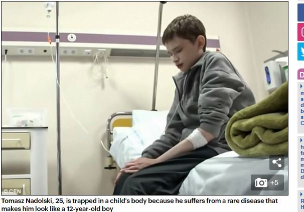 少年の身体に閉じ込められた25歳の男 ― 奇病の激痛、崩壊する家族、医者の誤診…壮絶すぎる闘病生活の画像1