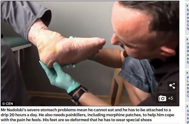 少年の身体に閉じ込められた25歳の男 ― 奇病の激痛、崩壊する家族、医者の誤診…壮絶すぎる闘病生活の画像4