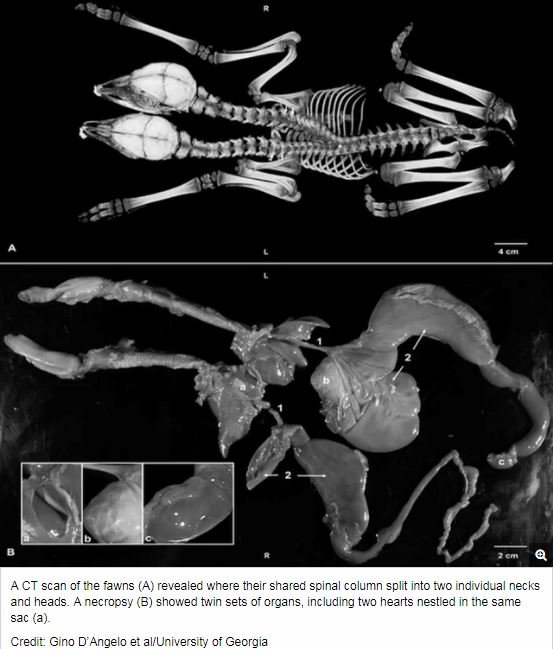 超絶珍しい「双頭鹿」が発見される！ 330年で19例、野生動物の結合双生児を待ち受ける悲しい運命とは!?の画像2