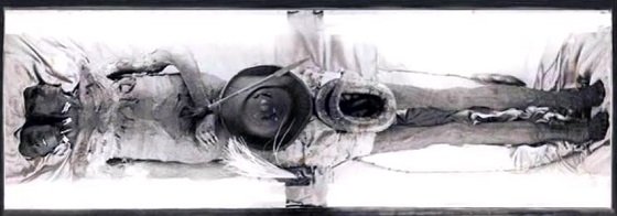 結合双生児の巨人だった!? 身長3.7m、パタゴニアの双頭ミイラ「Kap Dwa」の謎の画像1