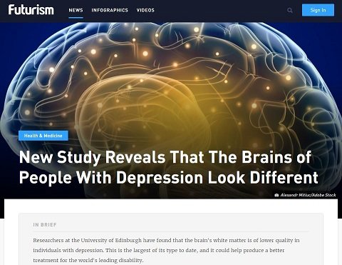 うつ病は脳の病気であることが科学的に判明か!? 史上最大級のリサーチで脳内の質の低下が発見される！の画像2