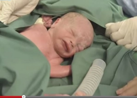 世界初の子宮移植ベビーが誕生！　医療技術の発達はここまできた！の画像1