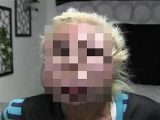 デコボコの肌、腫れ上がった瞼… 美容整形に取りつかれた世界の女たちの「成れの果て」