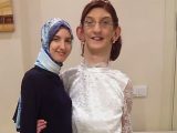 213.6cmのトルコの女子高生!?  寝て起きたら4.5センチ身長が伸びていた…巨人たちのエピソード