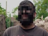 実在する狼男の苦悩 ― 「先天性多毛症」に悩む患者の現実に、心が痛くなる!!