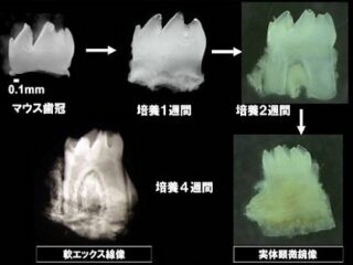 もうすぐインプラント終焉、失った歯を培養して完全再生できるようになる？ 大変革期に突入した歯科医療の最前線を徹底解説