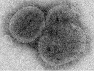 未だ解明されない謎の激ヤバな最凶ウイルス10！ 出血、発熱、死亡…アウトブレイクで人類滅亡!?