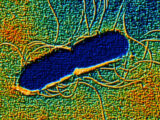 致死率95%超え、意識障害、皮膚突き破り…!  “人間の目には見えない”極小の殺人バクテリア5選!