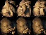 喫煙女性の胎内で、赤ちゃんが苦しがる姿が映し出される!! 恐ろしいタバコの害がまた一つ判明