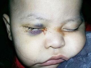 男性器、両眼球、全歯を喪失……!!　悲惨すぎる医療ミス5選！