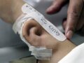 失った耳を腕で培養して再建→側頭部にくっつけて完成！ 最先端外科手術の様子がキモスゴい＝中国