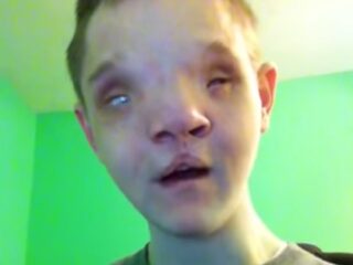 25もの疾患を抱える男性の前向きメッセージが感動呼ぶ!!