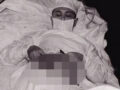 自らの腹部を切開した男 ― 極限状態で決死の手術＝旧ソ連