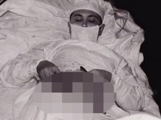 自らの腹部を切開した男 ― 極限状態で決死の手術＝旧ソ連