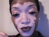 【奇病】全身“白まだら”の黒人美女が衝撃のすっぴん姿を初公開! 厚化粧を捨てて自分を認めるため… 尋常性白斑に立ち向かう!