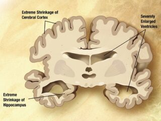 【老化度テスト】あなたの脳は健康？ 脳の老化がわかる19の質問