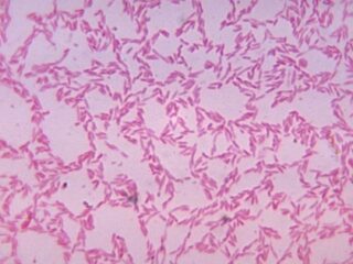 人類の半数以上が保持している新種の古代ウイルス「クラスファージ」が発見される