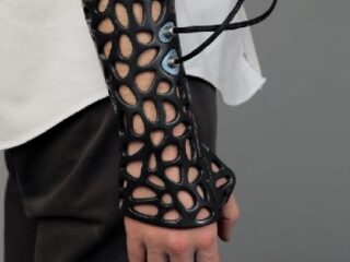 カッコよすぎる未来のギプス!! 骨折の治療速度38%アップ!?