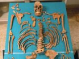 18世紀の去勢歌手「カストラート」の遺骨を解析! バチカンによるおぞましい少年身体改造の実態が明らかに!