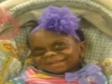 難病の少女の顔を笑う人々 ― 母「彼女はモンスターではない」=米