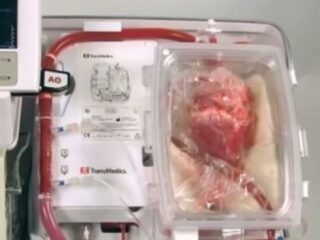 死んだ心臓を“生き返らせて”移植成功！　ドナー不足を解消する驚愕の新技術登場!!＝豪