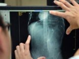 体内に5kgのウンコを溜め込んだ便秘男!! 巨大すぎる糞で心臓の位置まで変化していた!=中国