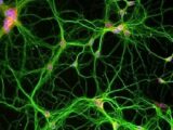 【ガチ科学】消したいトラウマ記憶を“切り抜く”技術が開発される! 一生思い出すことは不可能、洗脳に悪用される可能性も=アメリカ