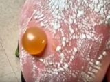 【閲覧注意?】日焼けでできた巨大水ぶくれがヤバすぎる!! 死をも招く恐怖の紫外線!!=米・オクラホマ