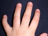人差し指よりも長い薬指を持つ子どもは自己中で攻撃的!?  モノを独り占めする傾向…実験で判明!
