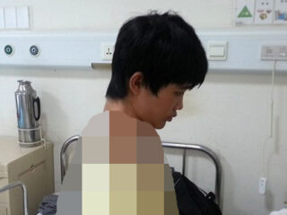【人体の不思議】長すぎる首を持つ少年 ― “アレの数”が3個も多かった!!＝中国
