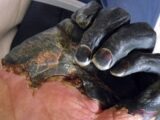 「黒死病」に感染するとどうなるの!? 生死の境をさまよった末に生還した、元感染者が語る!