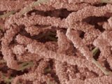【食事中閲覧注意】歯にまとわりつくエイリアン? 驚愕の歯垢写真!