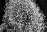 【エボラ】ワクチン開発不要論! “無症候者”の免疫システム研究がカギ?(医学論文)