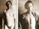 麻酔なしで信者全員去勢、乳首と女性器も切除 ― ロシア、恐るべき異端の宗教「スコプツィ」とは?