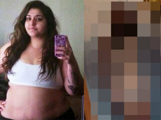 150キロ→56キロへ！ 90キロ激ヤセした女性が払った“凄まじい代償”とは!?