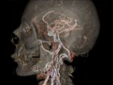 人体が全て丸見えに! 芸術的なまでの高精細映像機能を誇る驚異のCTスキャナー!