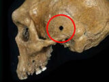30万年前のローデシア人の頭蓋骨に明らかな“銃痕”! スナイパーにこめかみを撃ち抜かれた可能性も!?