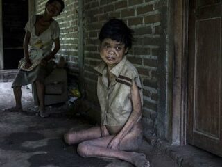 障害者400人が隔離・鎖に繋がれた「呪われた村」！ 恐ろしいほど残酷な差別の実態とは？＝インドネシア