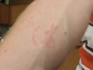 1,000匹のシラミを使ってタトゥーを彫る!? 体を張った痒～い大実験の壮絶内容！