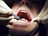 歯医者は患者の不安を「嗅ぎ取って」ミスを犯しやすくなることが判明! 患者のストレス臭が治療に影響(最新研究)