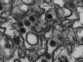 「ジカ熱」の感染拡大の原因はセックスだった？ 生物学者が妻との性行為で発見か？