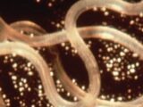 【衝撃】ガンは“感染”する ― 前代未聞、サナダムシにうつされたガンで死んだ男=コロンビア