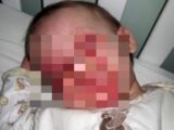「ママ、僕はもう死にたい」5歳児がこうまで訴える難病「FSGS」の絶望的病状とは!?