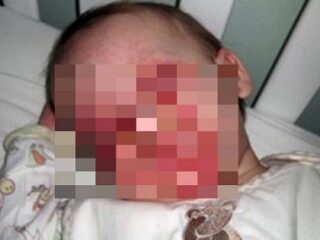 「ママ、僕はもう死にたい」5歳児がこうまで訴える難病「FSGS」の絶望的病状とは？