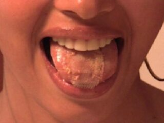 ミスコンで勝つために舌を縫った18歳の女！ 〜命がけの美容整形〜