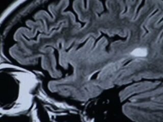 脳の詳細な地図、新たに100領域が発見される！ 人体最後の秘境“脳”の謎