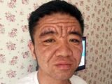 30歳なのに80歳の容姿! 男が突然“超老け顔”になった謎の症状が怖すぎる!!=中国
