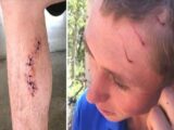 3年間にヘビ・クマ・サメによる連続襲撃を受けた世界一不運な男! 確率89京3千兆分の1!